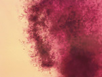 MISSING THUMBNAIL
